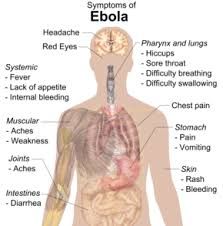  الحمى النزفية إيبولا 